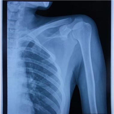 بلیو لیزر فلم